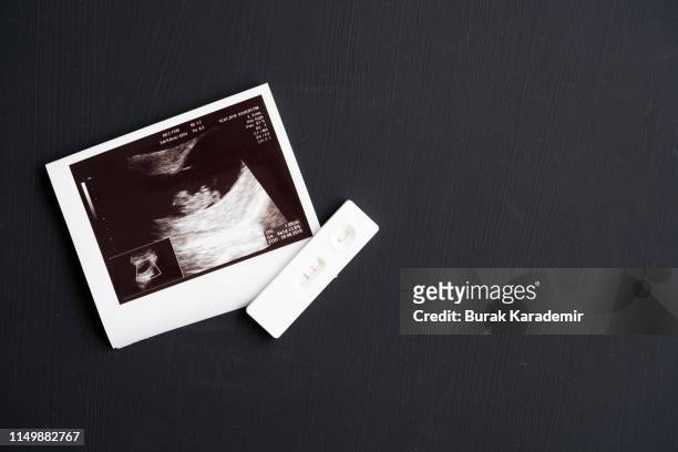 foetus ultrasound - embarazada fotos fotografías e imágenes de stock