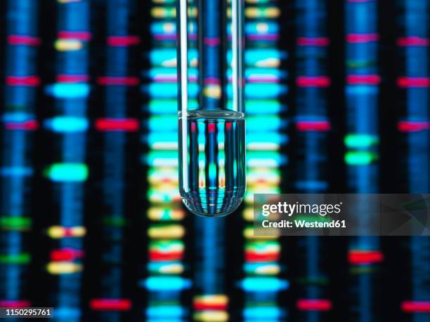 Random Dna Sample Genetic Research Dna Profile Reflected In A Test Tube Containing A ...