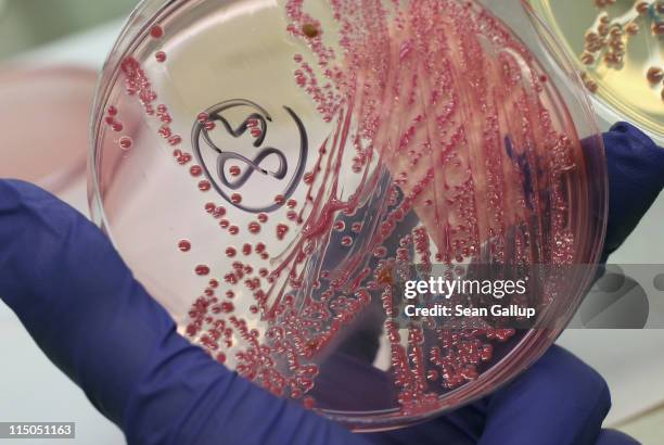 Lab technician holds a bacteria culture that shows a positive infection of enterohemorrhagic E. Coli, also known as the EHEC bacteria, from a patient...