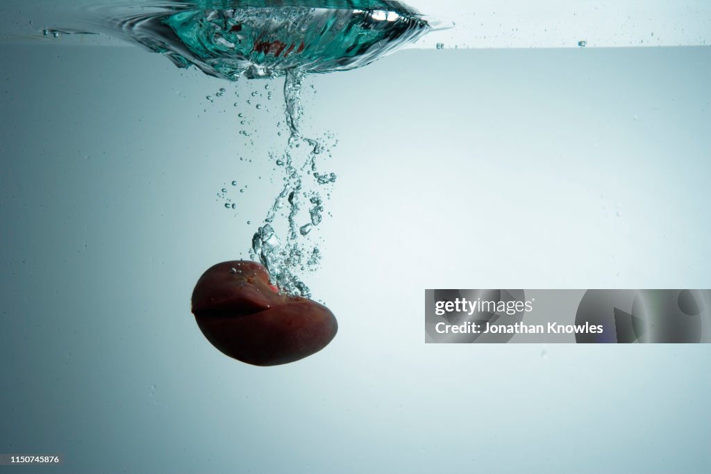 Kidney