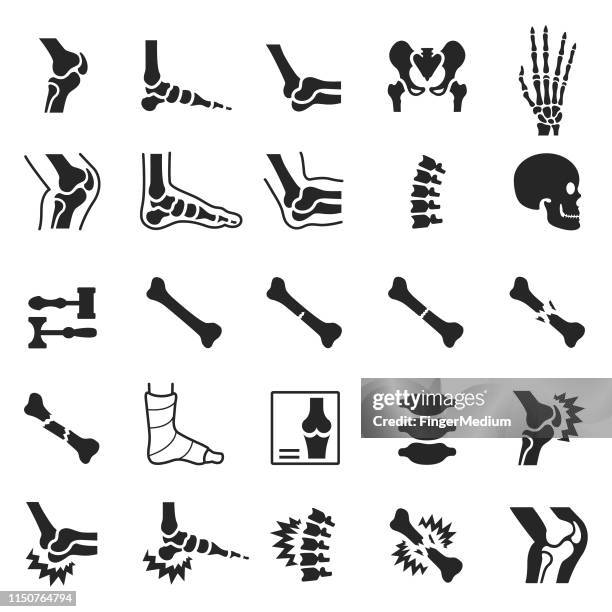 illustrazioni stock, clip art, cartoni animati e icone di tendenza di set di icone ortopediche - fracture