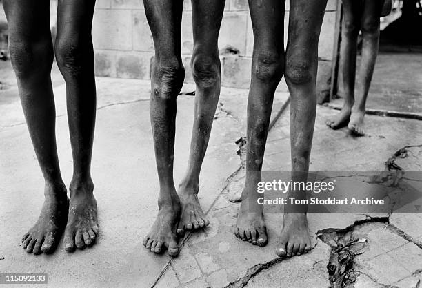 During 1989 children were starving during a severe drought in Southern Sudan which was made worse by a long running conflict between the Khartoum...