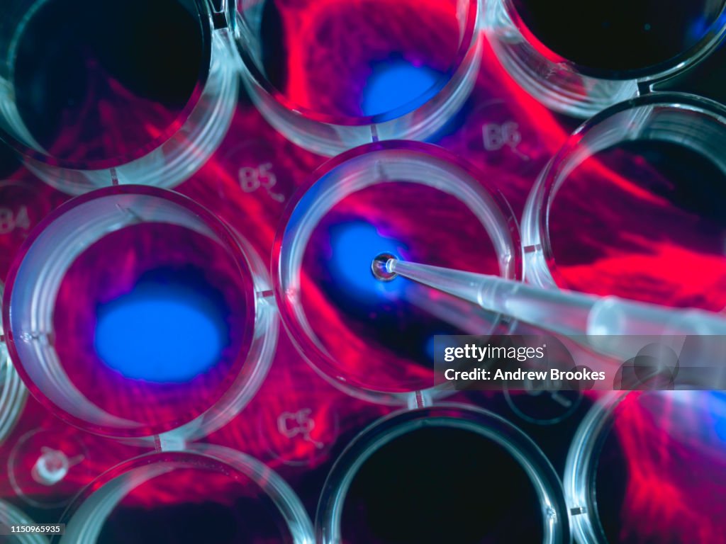 Stem cell research, scientist pipetting cells into a multi well plate with screen image of stem cells in the background