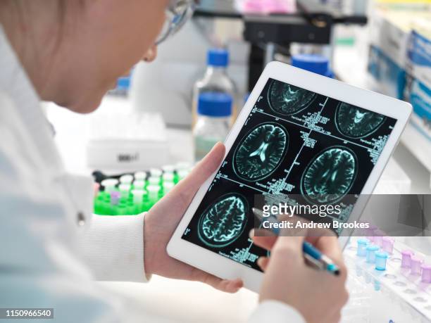 doctor viewing patient's brain scan on digital tablet in laboratory - 老人痴呆症 個照片及圖片檔