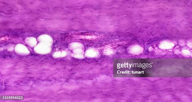 cross section of dense connective tissue - tendon stock pictures, royalty-free photos & images