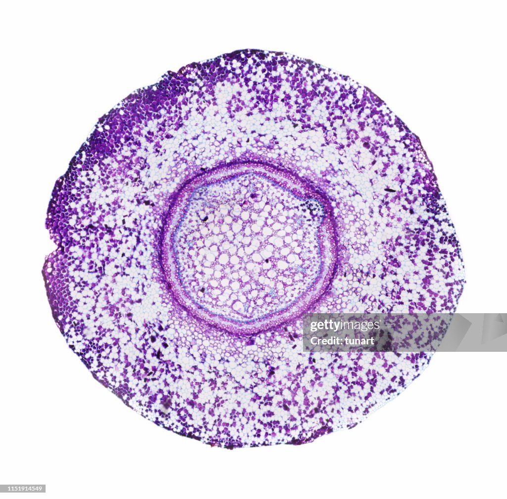 Microscopic View of Cross Section of Fern Root