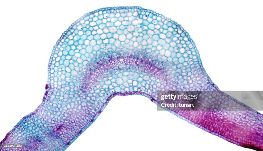 High Resolution Microscopic View of Cross Section of Leaf of Winter Jasmine