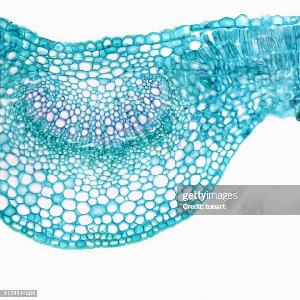 vue microscopique de la section transversale de la feuille de lilas - cellule végétale photos et images de collection