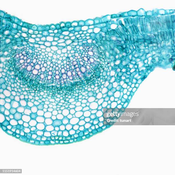 microscopische weergave van de dwarsdoorsnede van lila blad - vergroting stockfoto's en -beelden