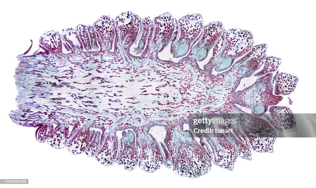 Vista microscopica della sezione trasversale della pigna femmina