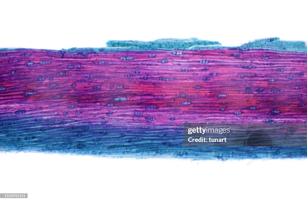 Microscopic View of Cross Section of Pine Stem
