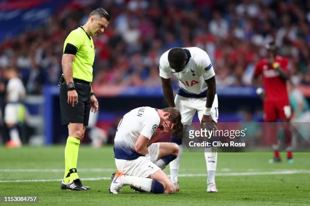 Jan Vertonghen of Tottenham Hotspur reacts with an injury during the UEFA Champions League Final between Tottenham Hotspur and Liverpool at Estadio...