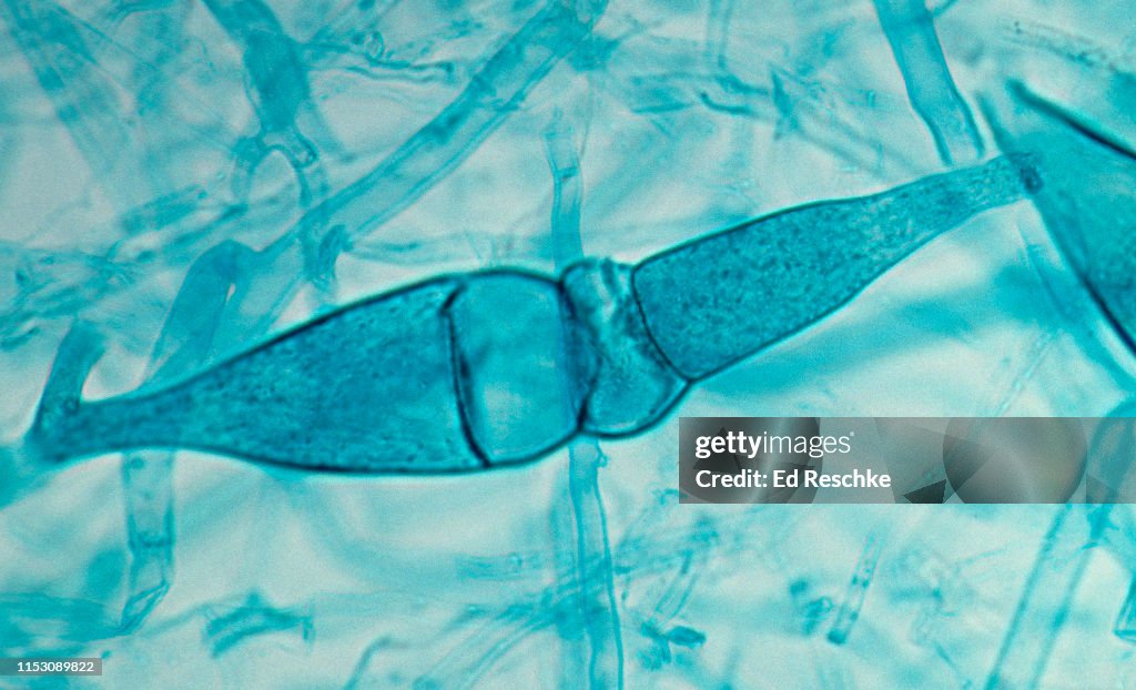 BLACK BREAD MOLD (Phizopus stolonifer) SEXUAL REPRODUCTION, GAMETES and YOUNG ZYGOSPORE, 100X