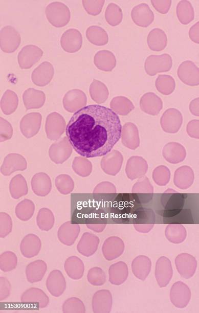 Monocyte Rbc Monocyte Photos and Premium High Res Pictures - Getty Images