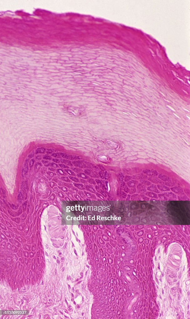 EPIDERMIS of the skin showing 5 Layers, Palm, 50X