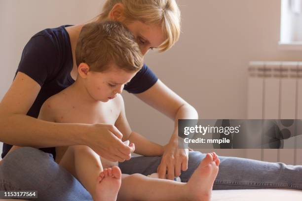 maman me guérit - varicelle photos et images de collection