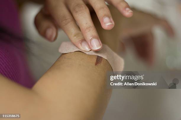 bandage covering wound - injured woman stock pictures, royalty-free photos & images