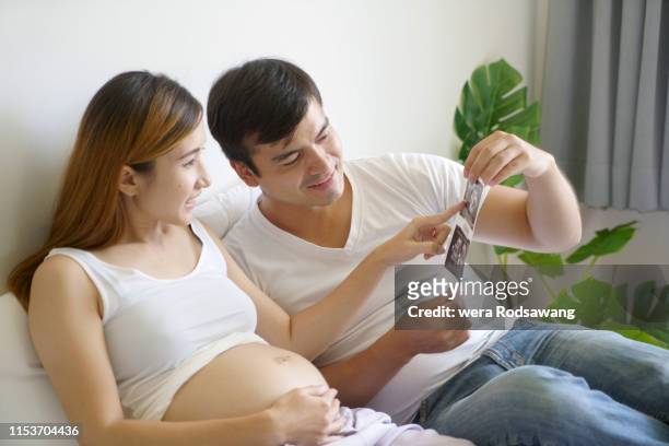 happiness of married couple looking the baby ultrasound paper , husband take care wives during pregnancy - morning sickness stock-fotos und bilder