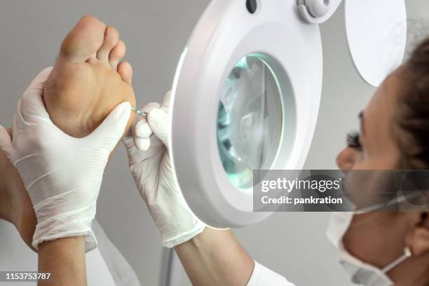pedicura profesional utilizando máquina eléctrica para quitar las callosidades del pie - warts fotografías e imágenes de stock