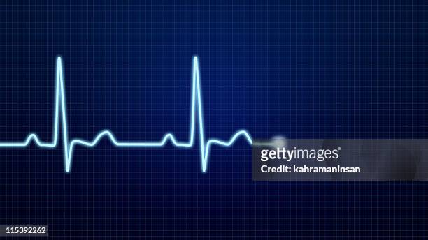 ekg pulse waveform - heartbeat stockfoto's en -beelden