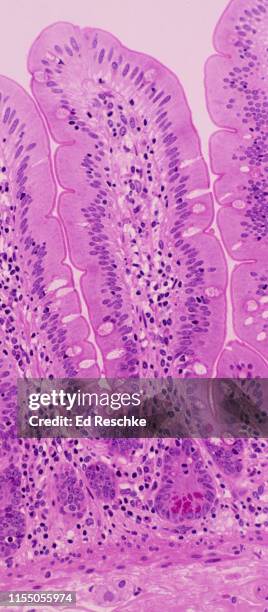 villus in the small intestine and paneth cells in an intestinal gland, 100x - paneth cell stock-fotos und bilder