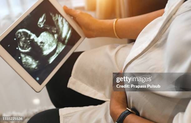 baby holding tablet pc. concept: ultrasound image of baby in mother's womb. isolated on white - command sisters photos et images de collection