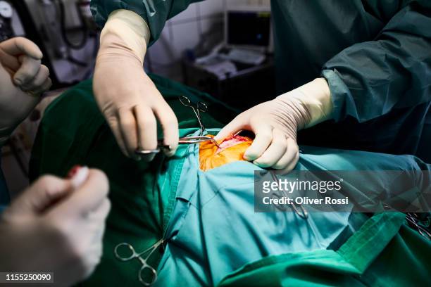 close-up of veterinarians operating a dog in animal hospital - 外科用ハサミ ストックフォトと画像
