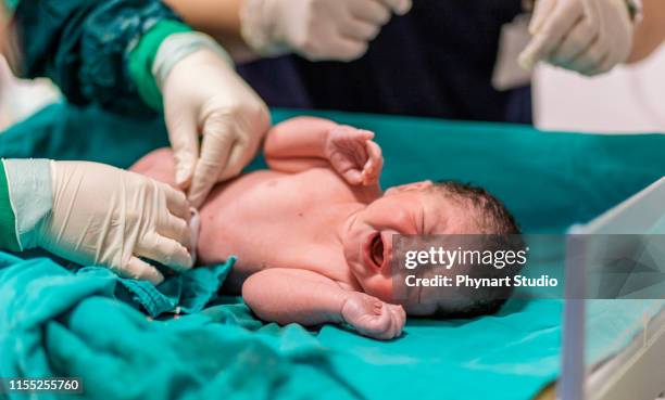 doctor cutting baby's umbilical cord - birth imagens e fotografias de stock