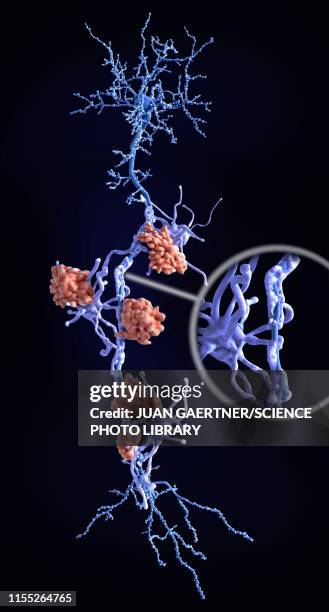 nerve damage in multiple sclerosis, illustration - microglia stock illustrations