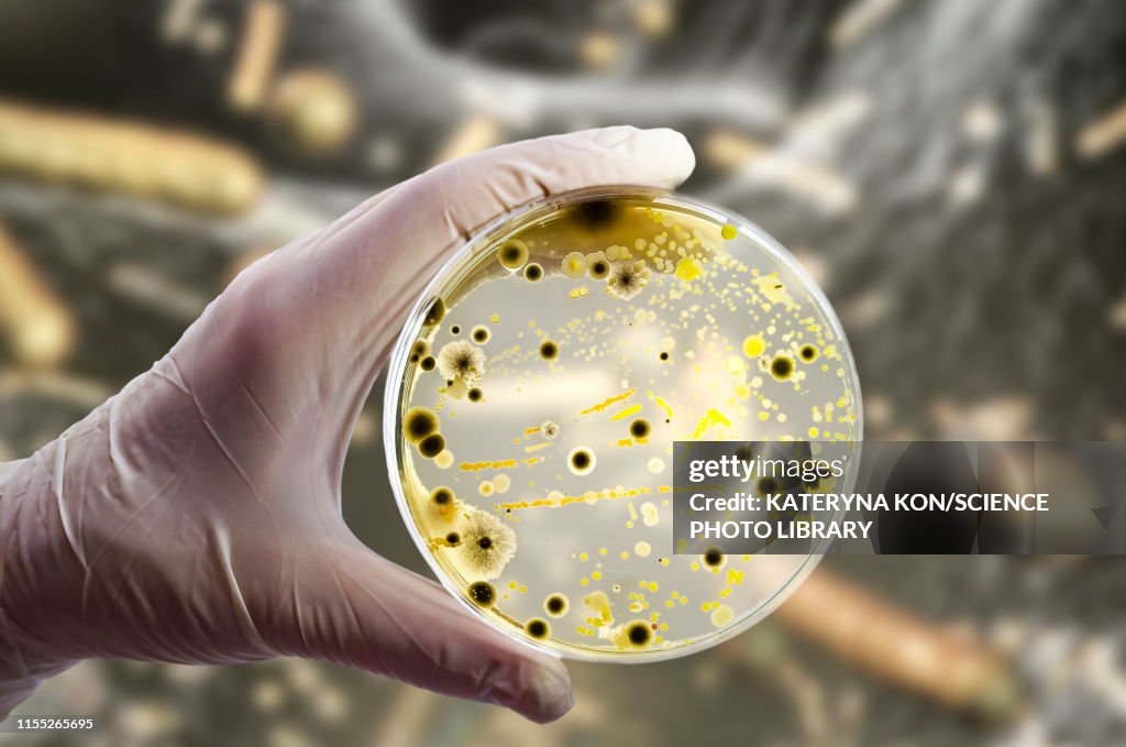 Bacterial and fungal cultures, composite image