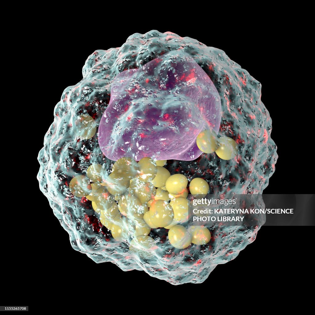 Macrophage foam cell, illustration