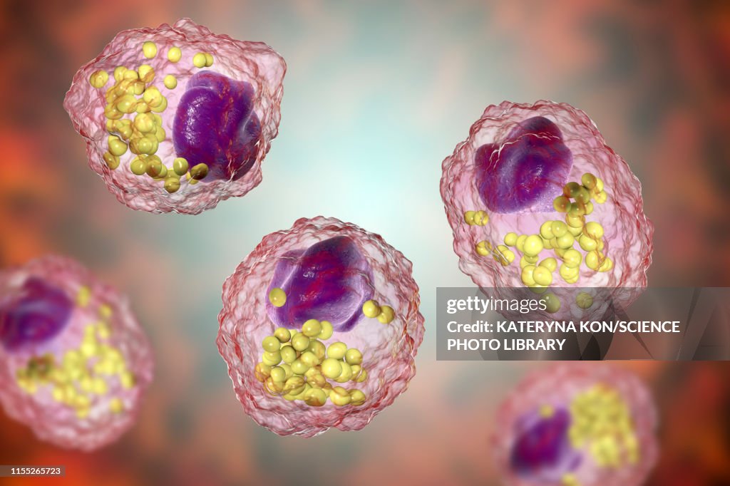 Macrophage foam cell, illustration