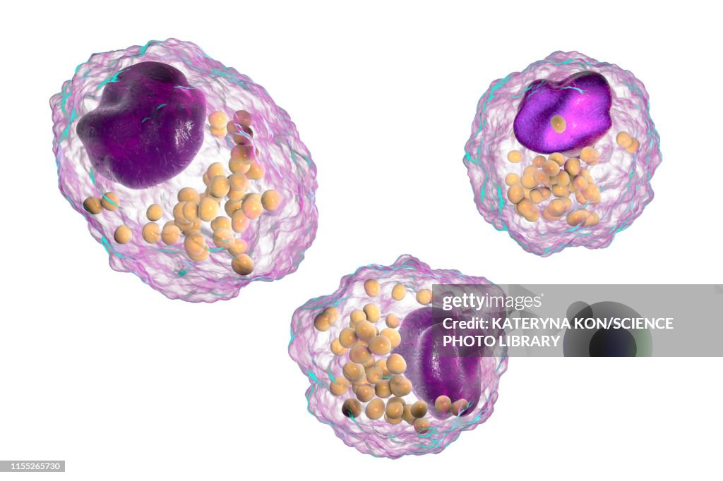 Macrophage foam cell, illustration