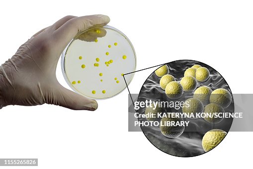 Micrococcus luteus bacteria, composite image Micrococcus luteus bacteria, composite image