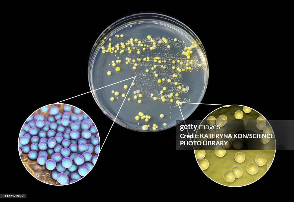 Bacterial culture grown from human skin, composite image