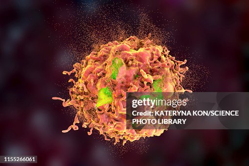 Malignant Cell Exploding Destruction Of A Cancer Cell Illustration High-Res Vector Graphic ...