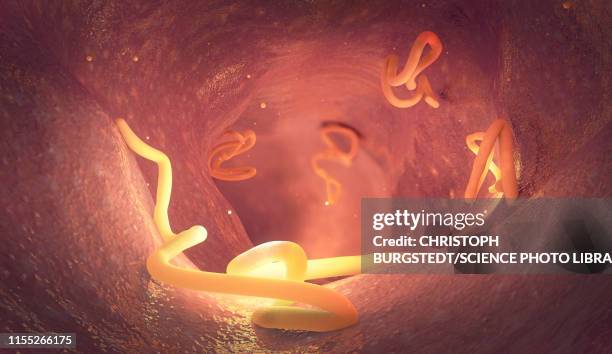 illustrazioni stock, clip art, cartoni animati e icone di tendenza di tapeworm infestation in human intestine, illustration - ancylostoma caninum