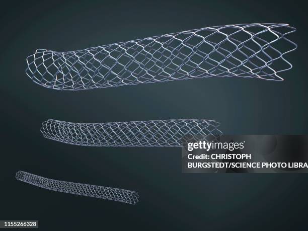 stent, illustration - stent fotografías e imágenes de stock