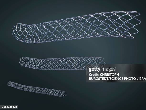 Stent Rima 150 Cardiology Stent Stock Photos, High-Res Pictures, and Images ...