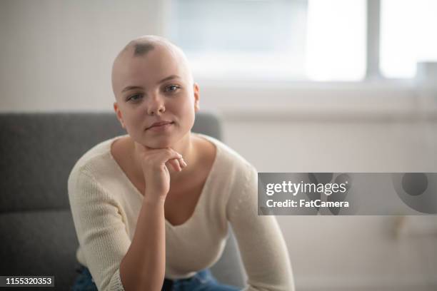denken over ziekte - alopecia stockfoto's en -beelden