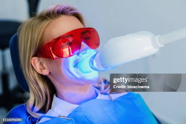 dentista odontoiatrico che lavora denti sbiancamento processo medico dentale - sbiancamento dentale foto e immagini stock