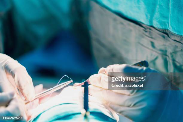 nahaufnahme des chirurgen, der während der rhinoplastik-chirurgie stiche macht - nasenkorrektur stock-fotos und bilder