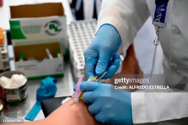 Technician extracts blood from a patient for an HIV test at the Condesa Clinic, which specialises in HIV, in Mexico City on July 18, 2019. - The 10th...