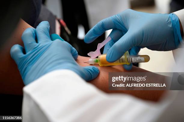 Technician extracts blood from a patient for an HIV test at the Condesa Clinic, which specialises in HIV, in Mexico City on July 18, 2019. - The 10th...