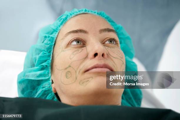 young woman lying on operating table for surgery - facelift stock pictures, royalty-free photos & images