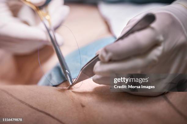surgeon using suture for stitching patient's skin - mani fili foto e immagini stock