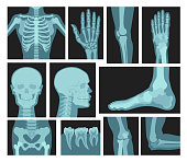 X rays of human body, medical equipment