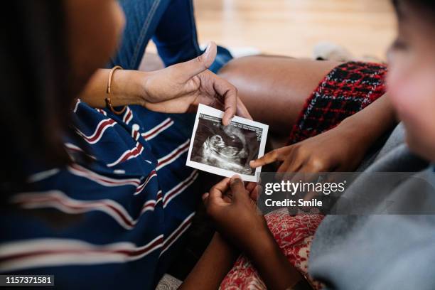 young couple looking at pregnancy trimester ultrasound - pregnant couple stock-fotos und bilder