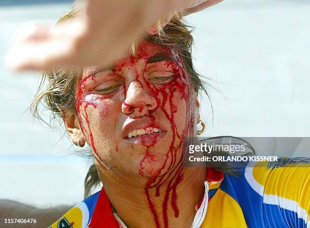 Venezuelan cyclist Daniela Larreal, revieves medical attention after falling from her bycicle during the last round of the woman's cycling...