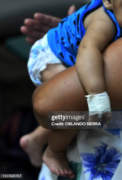 Baby infected with dengue, which vector is the Aedes aegypti, is assisted in the Roberto Suazo Cordova Hospital, in La Paz municipality, La Paz...